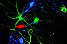 Čudesna lepota neurona