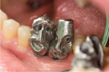 Gyneaologia dyslectica