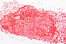 Oponašanje prirodnog crteža ljudske kože